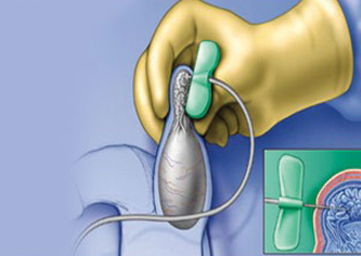 Neonatology